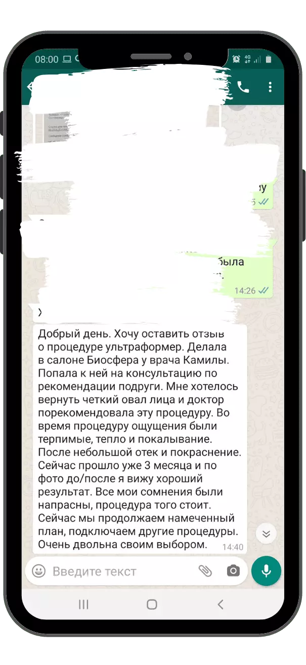 SMAS-лифтинг Ultraformer